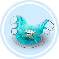 Лингвальные брекеты