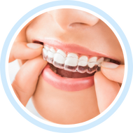 Элайнеры + 3D моделирование прикуса