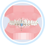 Детское 3D моделирование прикуса