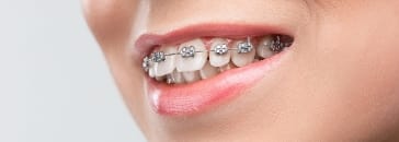 Ортодонтия