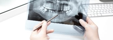 Рентгендиагностика